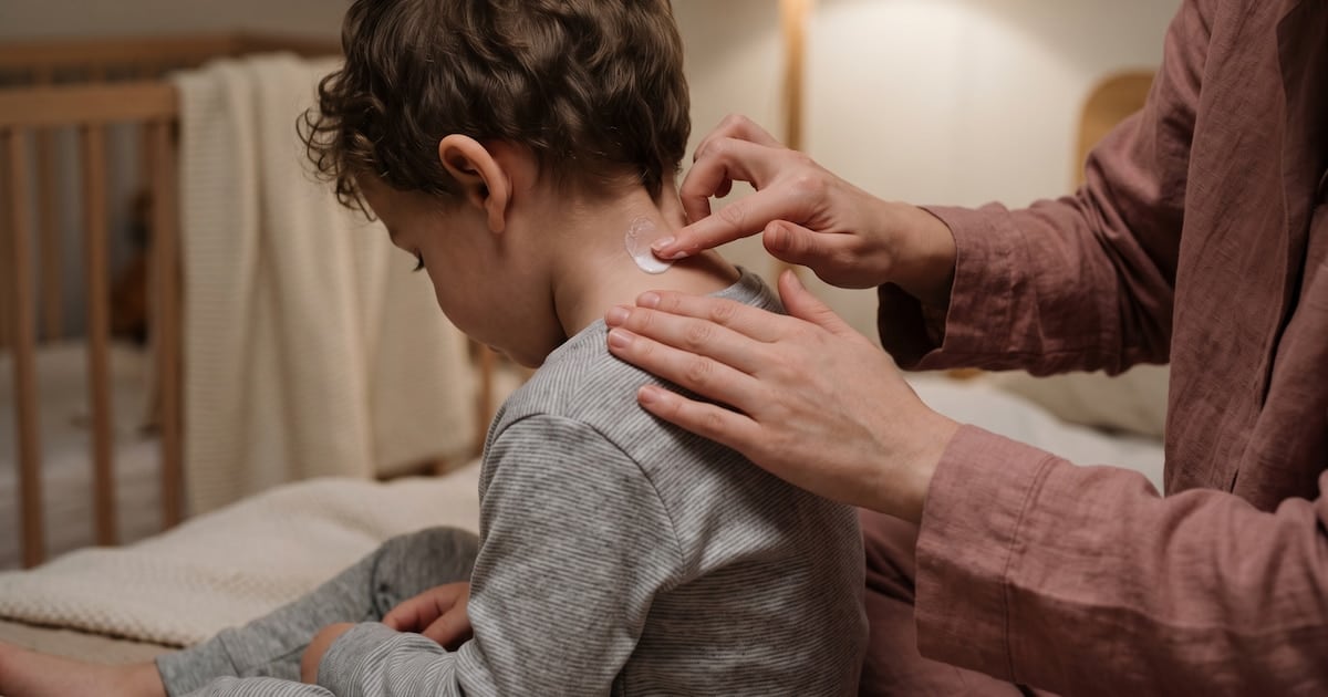 La dermatitis atópica no descansa: cuando el bolsillo decide si te rascás o te atendés