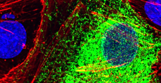 Una inteligencia artificial lee la actividad de los genes y diferencia células sanas de enfermas sin mirar el microscopio