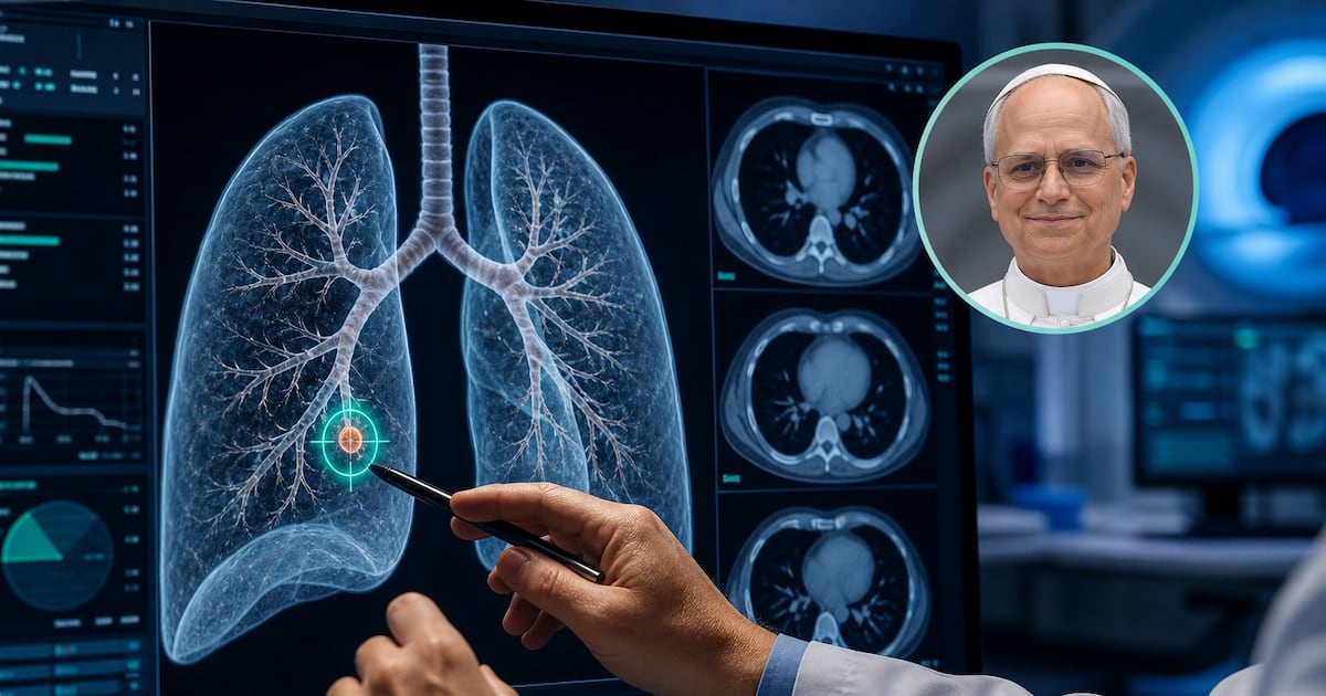 Qué es un nódulo pulmonar y por qué los médicos recomiendan operarlo aunque mida apenas unos milímetros